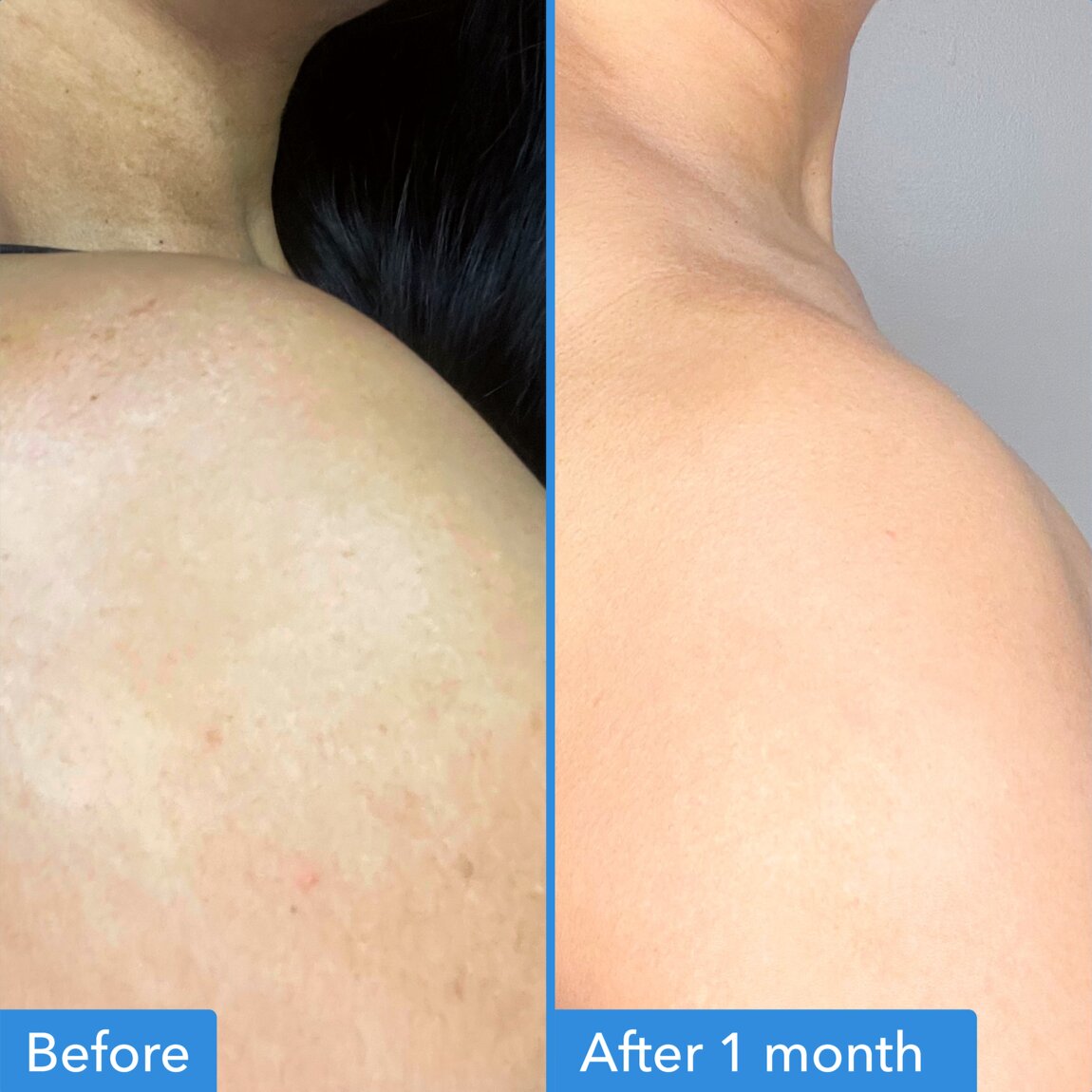discoloration-correcting-body-treatment-l2 zb_p.jpg