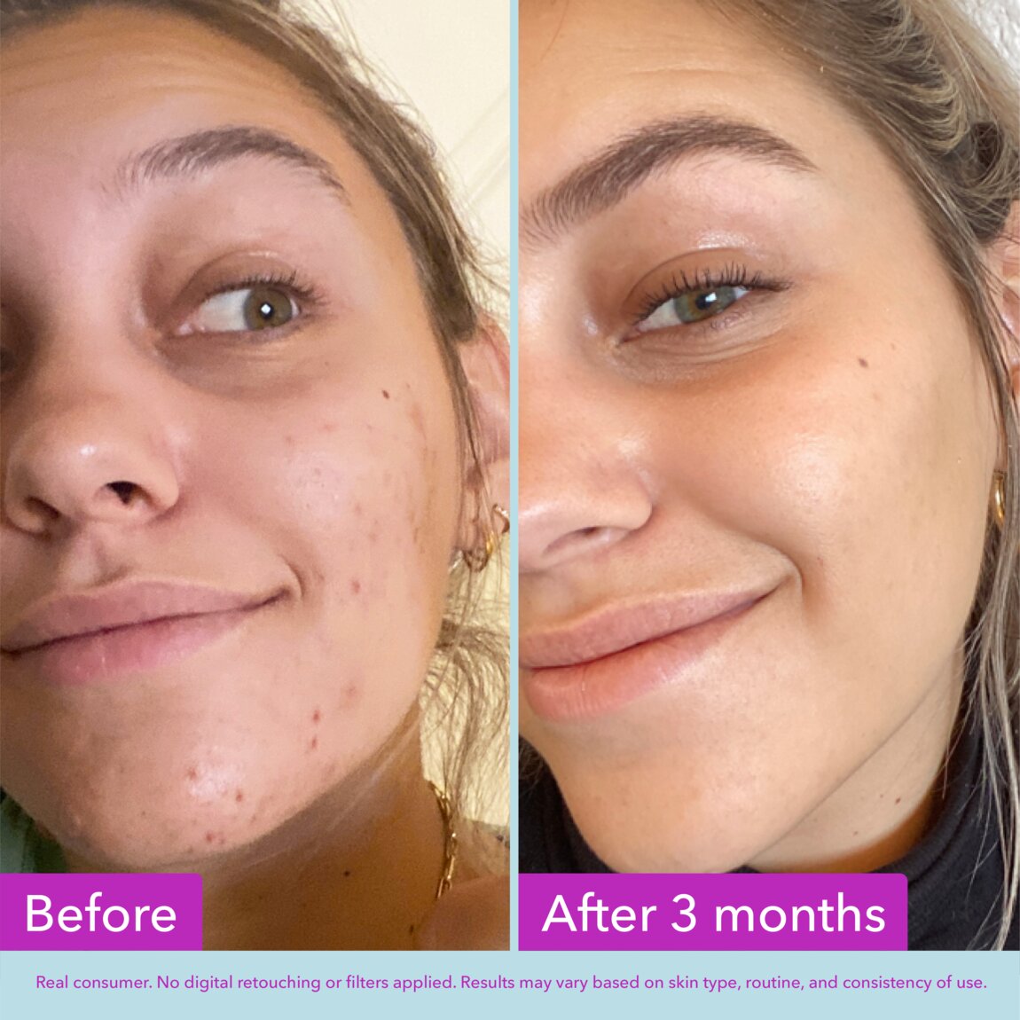 niacinamide-brightening-toner-l8 zb_p.jpg